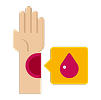 Easy bruising or bleeding Easy bruising or bleeding