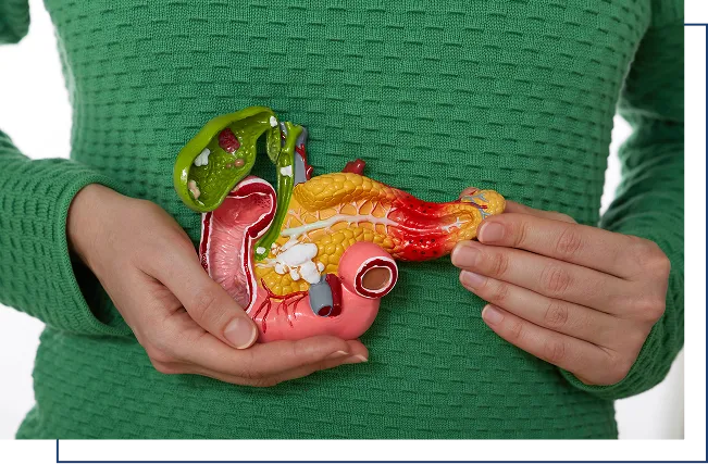 pancrea-tumor-types Types of Pancreatic Tumor
