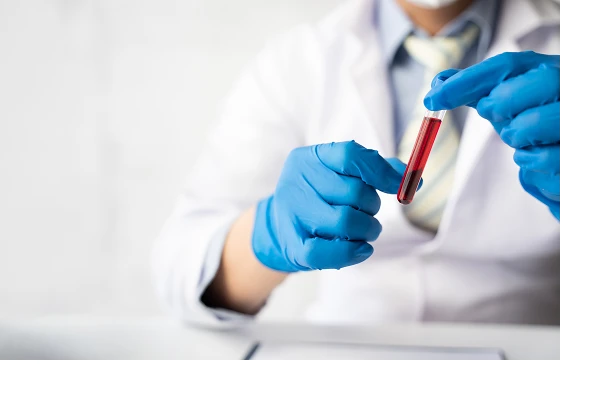 Acute Pancreatitis Evaluation Acute Pancreatitis Evaluation