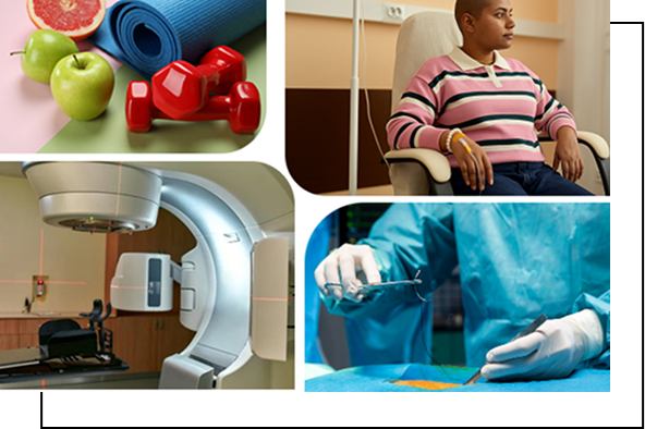 Colon Cancer management Colon Cancer management