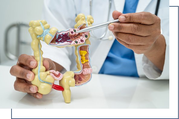 Colonoscopy Overview Colonoscopy Overview
