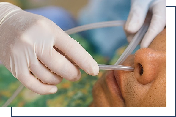 Endoscopy-guided NJ overview Endoscopy-guided NJ overview