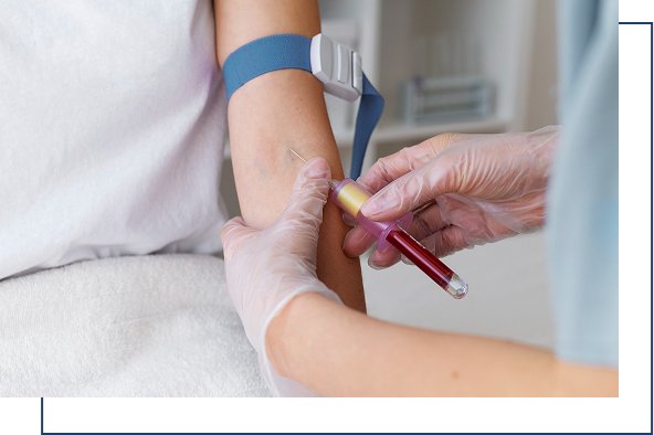 Hepatitis C Prevention Hepatitis C Prevention