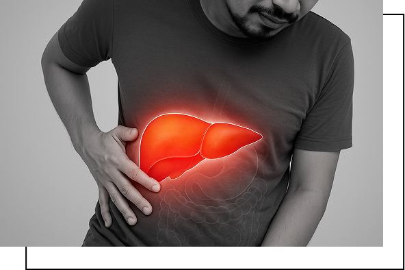 Liver Disease Overview Liver Disease Overview