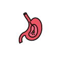 The doctor will insert a thin instrument with a camera into the body. The doctor will insert a thin instrument with a camera into the body.
