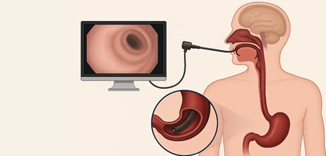 UGI Endoscopy facility page UGI Endoscopy facility page